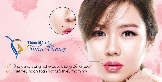 Tẩy nốt ruồi 